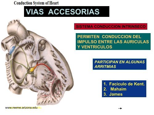 Arritmias Letales