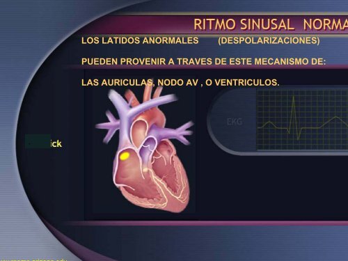 Arritmias Letales