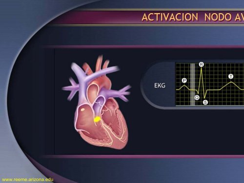 Arritmias Letales