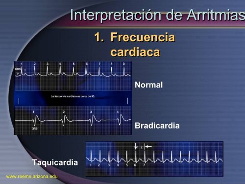 Arritmias Letales