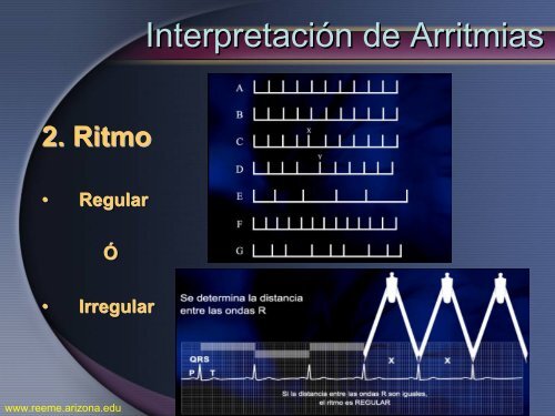 Arritmias Letales