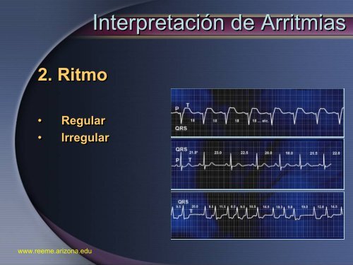 Arritmias Letales