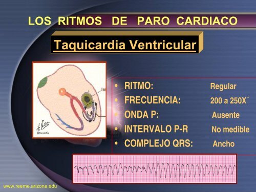 Arritmias Letales