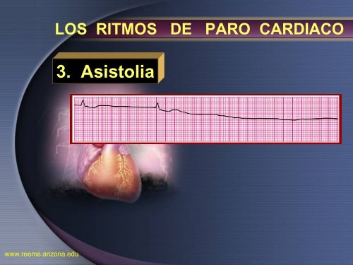 Arritmias Letales