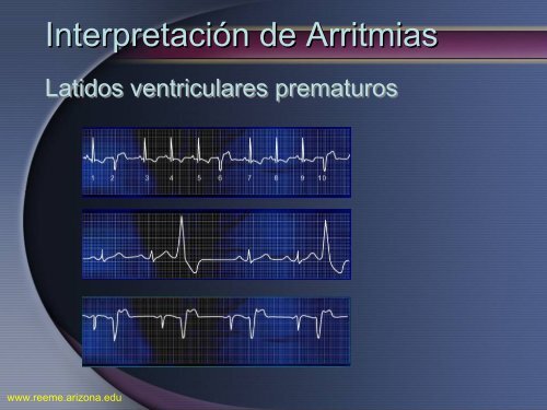 Arritmias Letales