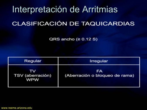 Arritmias Letales