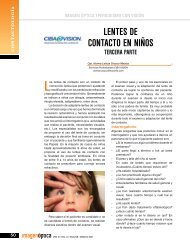 Lentes de contacto en niños. Tercera parte - Imagen Optica