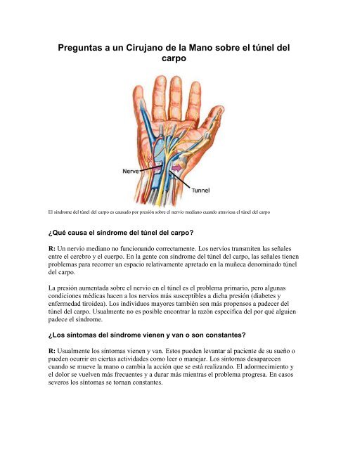 tunel carpal sintomas de diabetes tunel carpal sintomas de diabetes