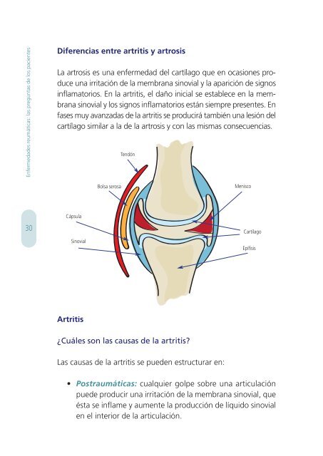 Enfermedades Reumáticas: Las preguntas de los pacientes - Pfizer