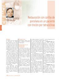 Restauración con carillas de porcelana en un ... - Gaceta Dental