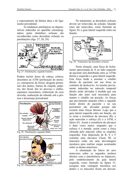 Roteiro de Estudo para Iniciantes em Oclusão _ Cap 05