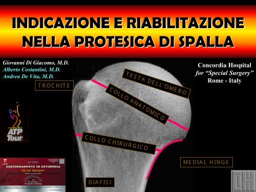 Formato PDF (12 MB) - La spalla