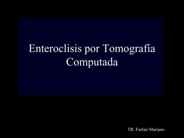 Enteroclisis por Tomografía Computada