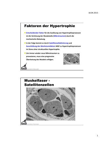 Faktoren der Hypertrophie Muskelfaser - Satellitenzellen - SAFS