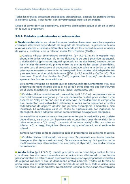 Cristales de oxalato de calcio en orina 2+