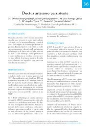 Ductus arterioso persistente - Sociedad Española de Neonatología