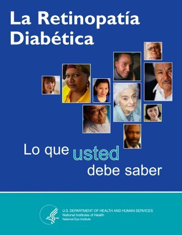 La Retinopatía Diabética: Lo que usted deber saber - National Eye ...