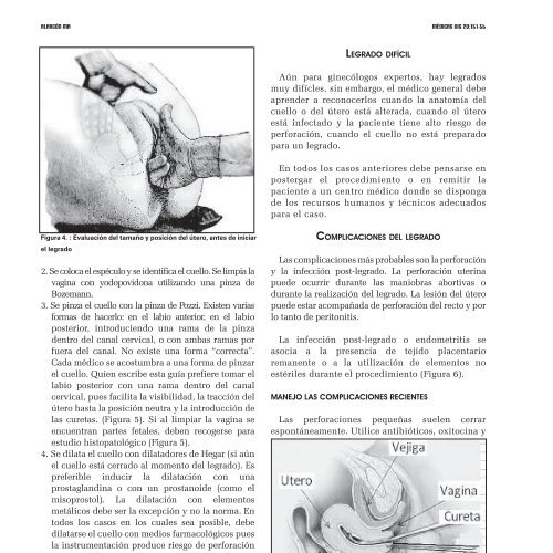 Riesgos del legrado uterino
