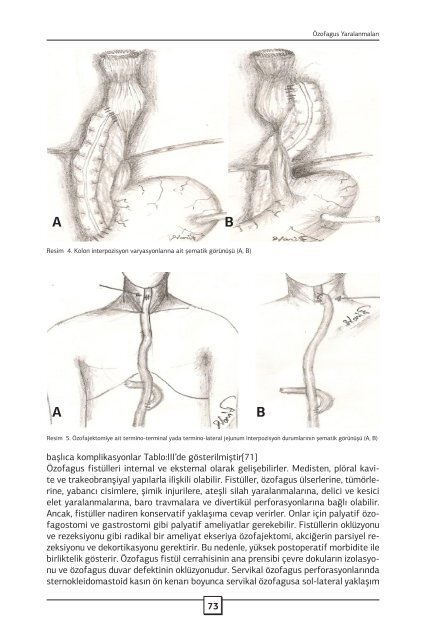 Özofagus Yaralanmaları - Journal of Clinical and Analytical Medicine