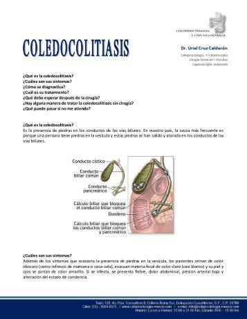 ¿Qué es la coledocolitiasis? ¿Cuáles son sus síntomas? ¿Cómo se ...