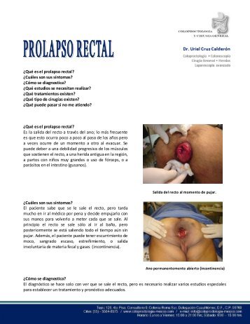 ¿Qué es el prolapso rectal? - Coloproctología (Enfermedades de ...