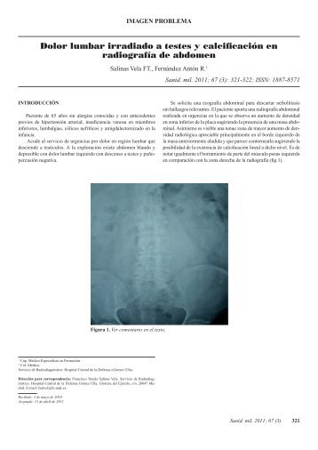 Dolor lumbar irradiado a testes y calcificación en radiografía de ...