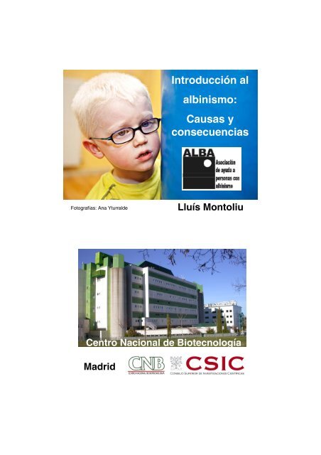 Causas y consecuencias del albinismo - Centro Nacional de ...