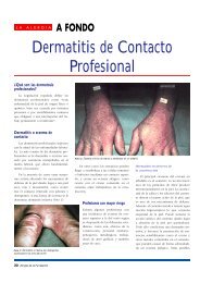 Dermatitis de Contacto Profesional