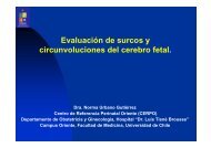 Evaluación de surcos y circunvoluciones del cerebro fetal. - CERPO