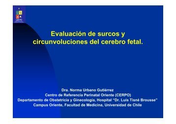 Evaluación de surcos y circunvoluciones del cerebro fetal. - CERPO