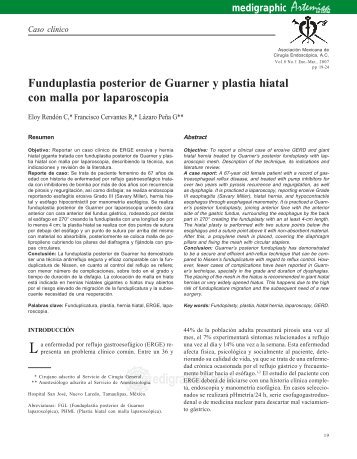 Funduplastia posterior de Guarner y plastia hiatal ... - edigraphic.com