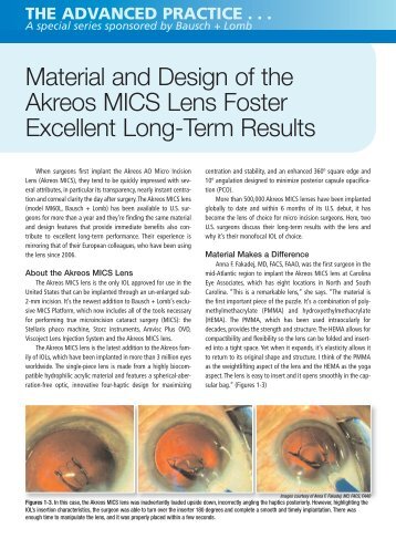 Material and Design of the Akreos MICS Lens ... - Bausch + Lomb