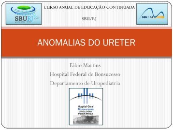 Aula de Anomalias do Ureter - SBU