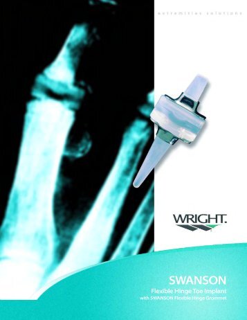 SWANSON Flexible Hinge Toe Implant