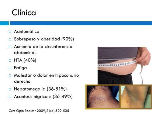 Hígado Graso en el paciente obeso.Dra. Angela M. Farías ... - Aveso