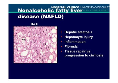 Hígado graso no alcohólico_Dr. Jaime Poniachick.pdf - Asociación ...