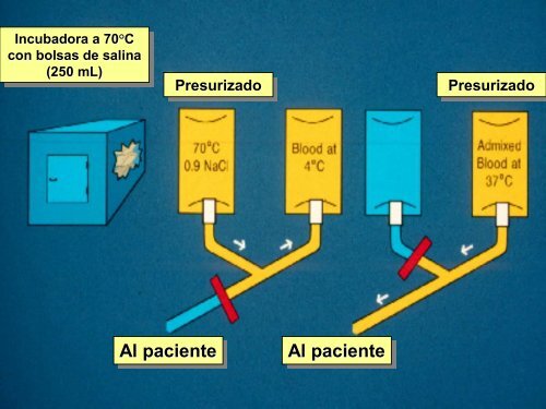 R á pido pido Calentamiento de Mezcla de Sangre Mezcla de Sangre