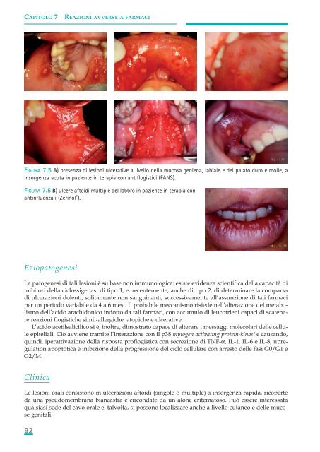 Allergie e reazioni avverse in Odontostomatologia - Associazione ...