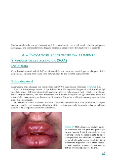 Allergie e reazioni avverse in Odontostomatologia - Associazione ...