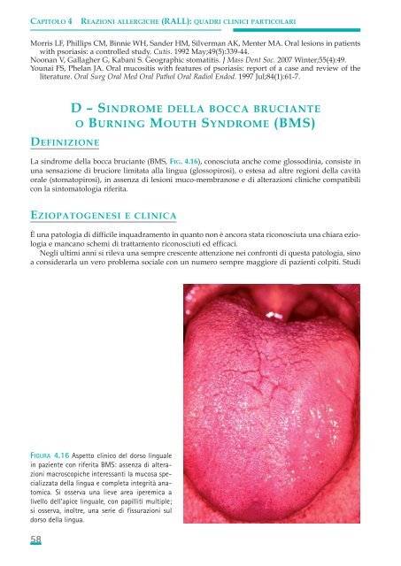 Allergie e reazioni avverse in Odontostomatologia - Associazione ...