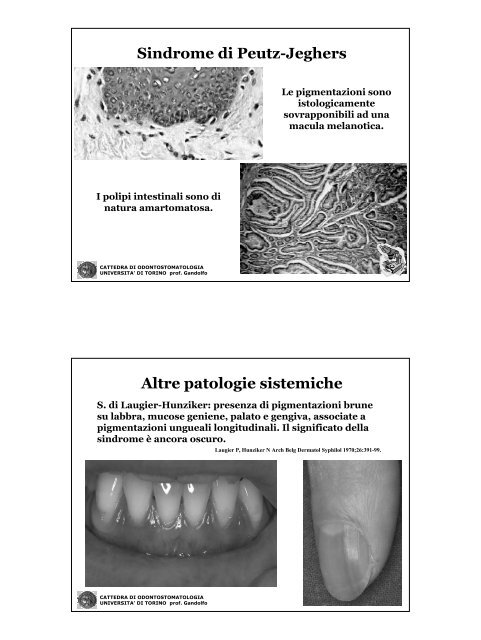 Lesioni pigmentate della mucosa orale
