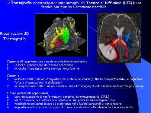 autismo - neuroimaging - ENGIM San Paolo