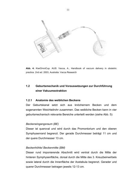 KiwiOmniCup als neues geburtshilfliches Instrument im Vergleich ...