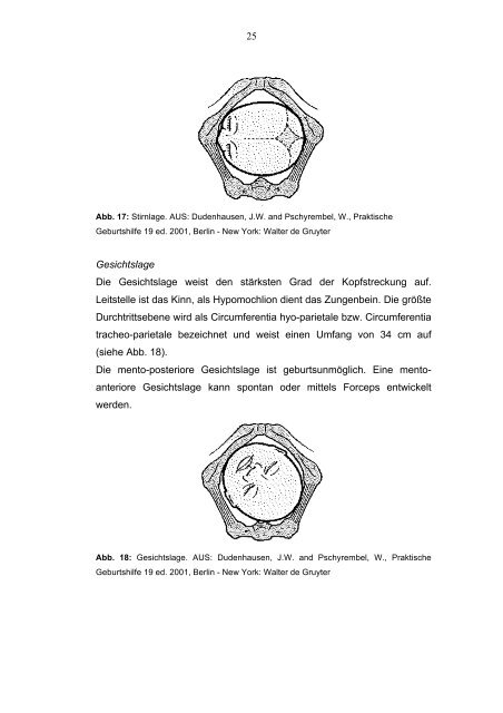 KiwiOmniCup als neues geburtshilfliches Instrument im Vergleich ...