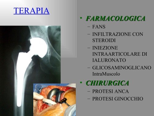 Patologia Osteoarticolare - Dipartimento di Farmacia