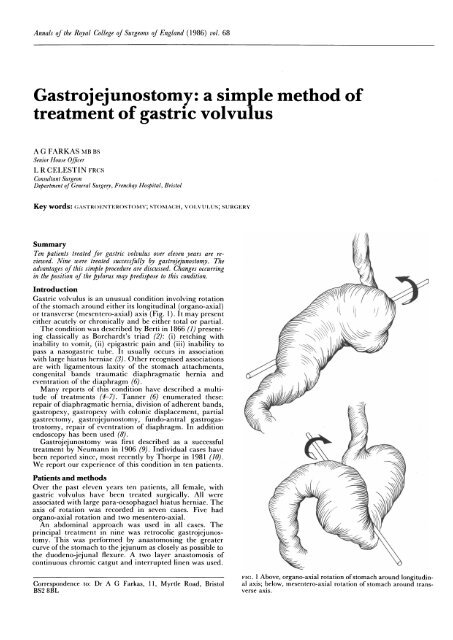 Gastrojejunostomy: a simple method of