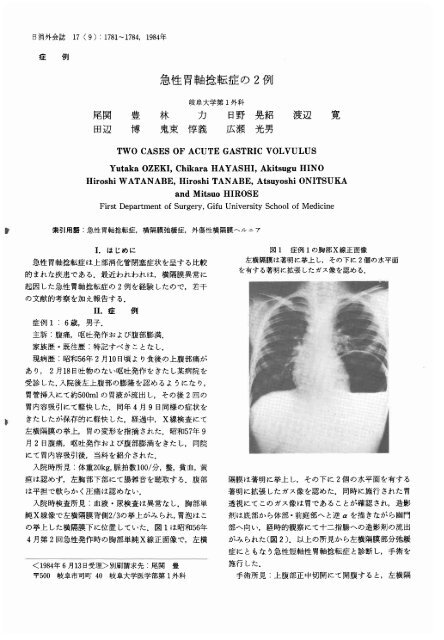 急性胃軸捻転症の2例 日本消化器外科学会