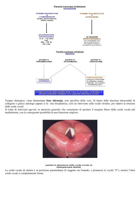 Appunti di ORL COSIMATO COSIMO, RUSSO ... - mediciunisa.it