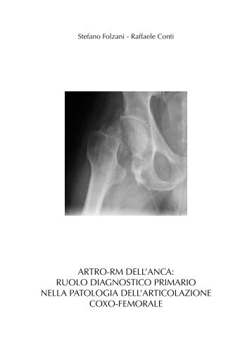 artro-rm dell'anca - Radiologia-folzani.it