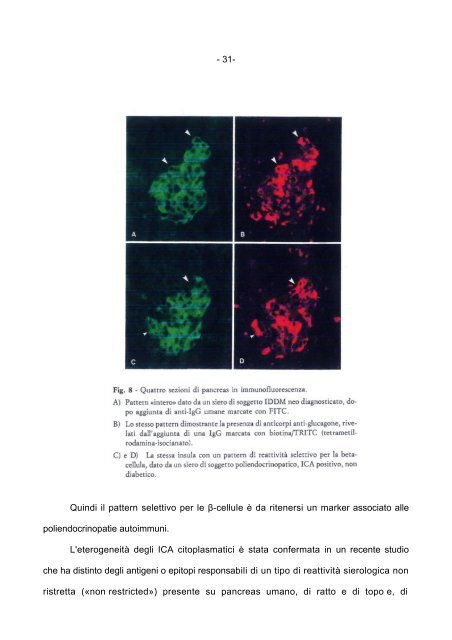 Le Sindromi Poliendocrine Autoimmuni